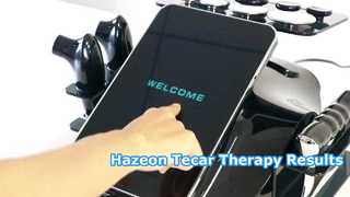 RL-W20 Hazeon Tecar Therapiegerät – Fortschrittliches 448-kHz-Physiotherapie- und Rehabilitationsgerät