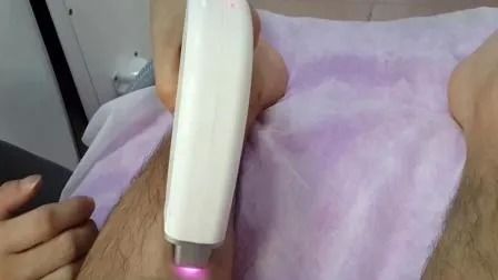 808nm Diodenlaser-Haarentfernungsgerät mit 1-50A Energie und 1-400ms Impulsbreite für 6 Hauttypen